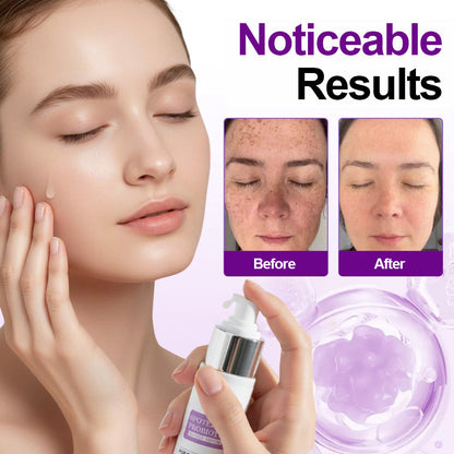 🌟SEAGRIL® 𝐒𝐩𝐨𝐭𝐄𝐫𝐚𝐬𝐞 𝐏𝐫𝐨𝐛𝐢𝐨𝐭𝐢𝐜 𝐒𝐡𝐢𝐞𝐥𝐝 𝐒𝐞𝐫𝐮𝐦 – Fades Dark Spots, Evens Skin Tone & Boosts Radiance✨💜