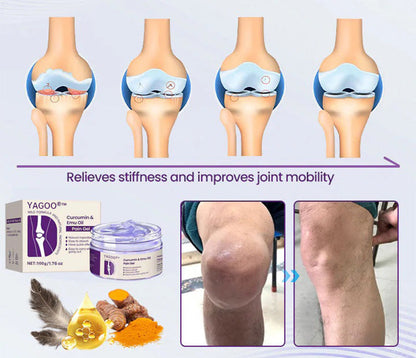 Yagoo®™ Curcumin & Emu Oil Pain Gel – 🏥Inspired by US Osteopathic Practices