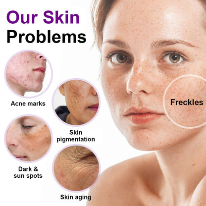 🌟SEAGRIL® 𝐒𝐩𝐨𝐭𝐄𝐫𝐚𝐬𝐞 𝐏𝐫𝐨𝐛𝐢𝐨𝐭𝐢𝐜 𝐒𝐡𝐢𝐞𝐥𝐝 𝐒𝐞𝐫𝐮𝐦 – Fades Dark Spots, Evens Skin Tone & Boosts Radiance✨💜