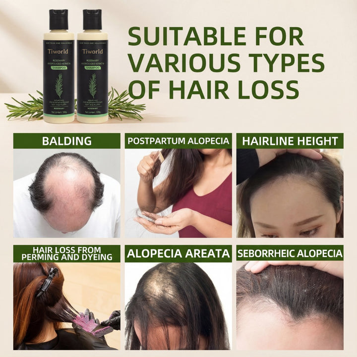 【Limited-time flash sale】Tiworld® Rosemary Shampoo