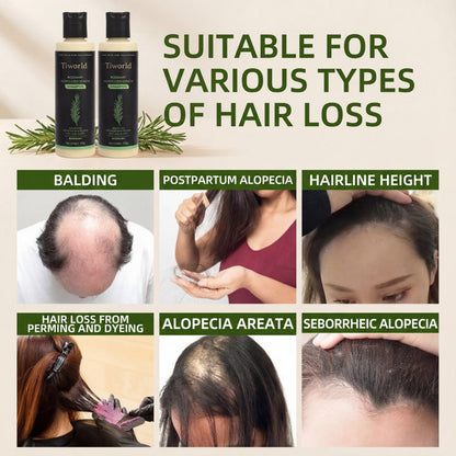 【Limited-time flash sale】Tiworld® Rosemary Shampoo