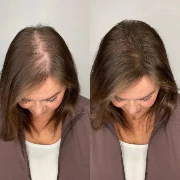 【Limited-time flash sale】Tiworld® Rosemary Shampoo