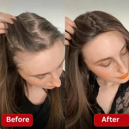 【Limited-time flash sale】Tiworld® Rosemary Shampoo