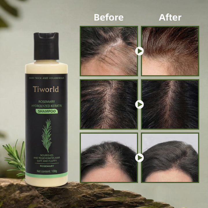 【Limited-time flash sale】Tiworld® Rosemary Shampoo