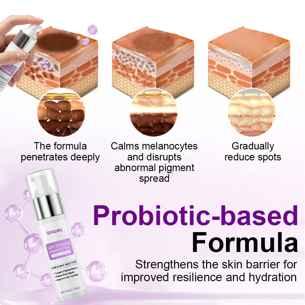 🌟SEAGRIL® 𝐒𝐩𝐨𝐭𝐄𝐫𝐚𝐬𝐞 𝐏𝐫𝐨𝐛𝐢𝐨𝐭𝐢𝐜 𝐒𝐡𝐢𝐞𝐥𝐝 𝐒𝐞𝐫𝐮𝐦 – Fades Dark Spots, Evens Skin Tone & Boosts Radiance✨💜