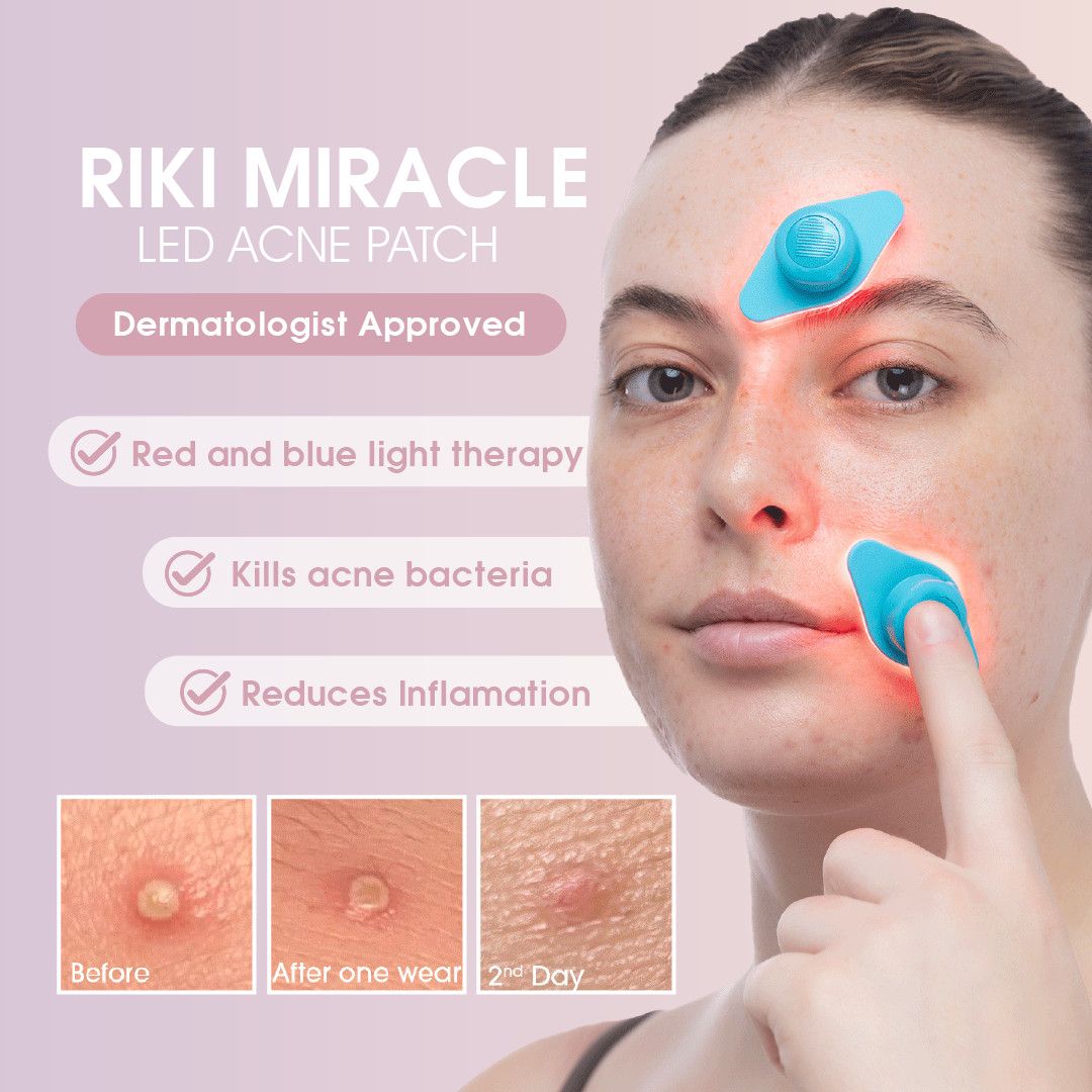🎄✨ RIKO Miracle Acne Erase Red & Blue Light Therapy Patch – Dermatologist-Approved, Painless Blemish Removal ✨🎄