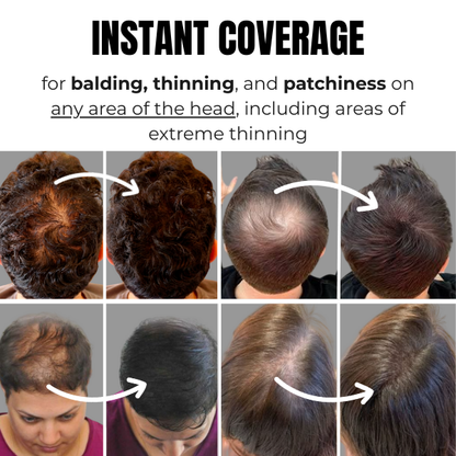 Tiworld 2.0 Hair Loss Powder